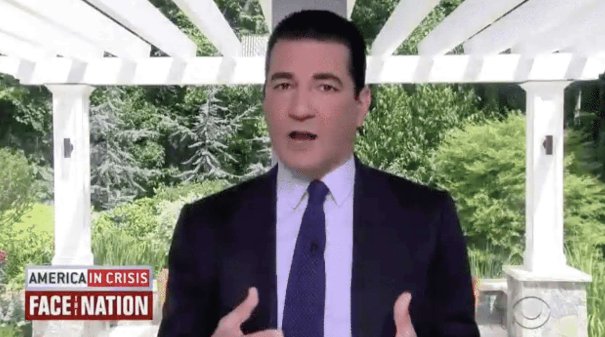 Scott Gottlieb Claims Some States Opened ‘Too Early’ in His View