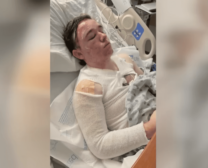 Worker Burned by Boiling Oil in Shocking Fast-Food Attack
