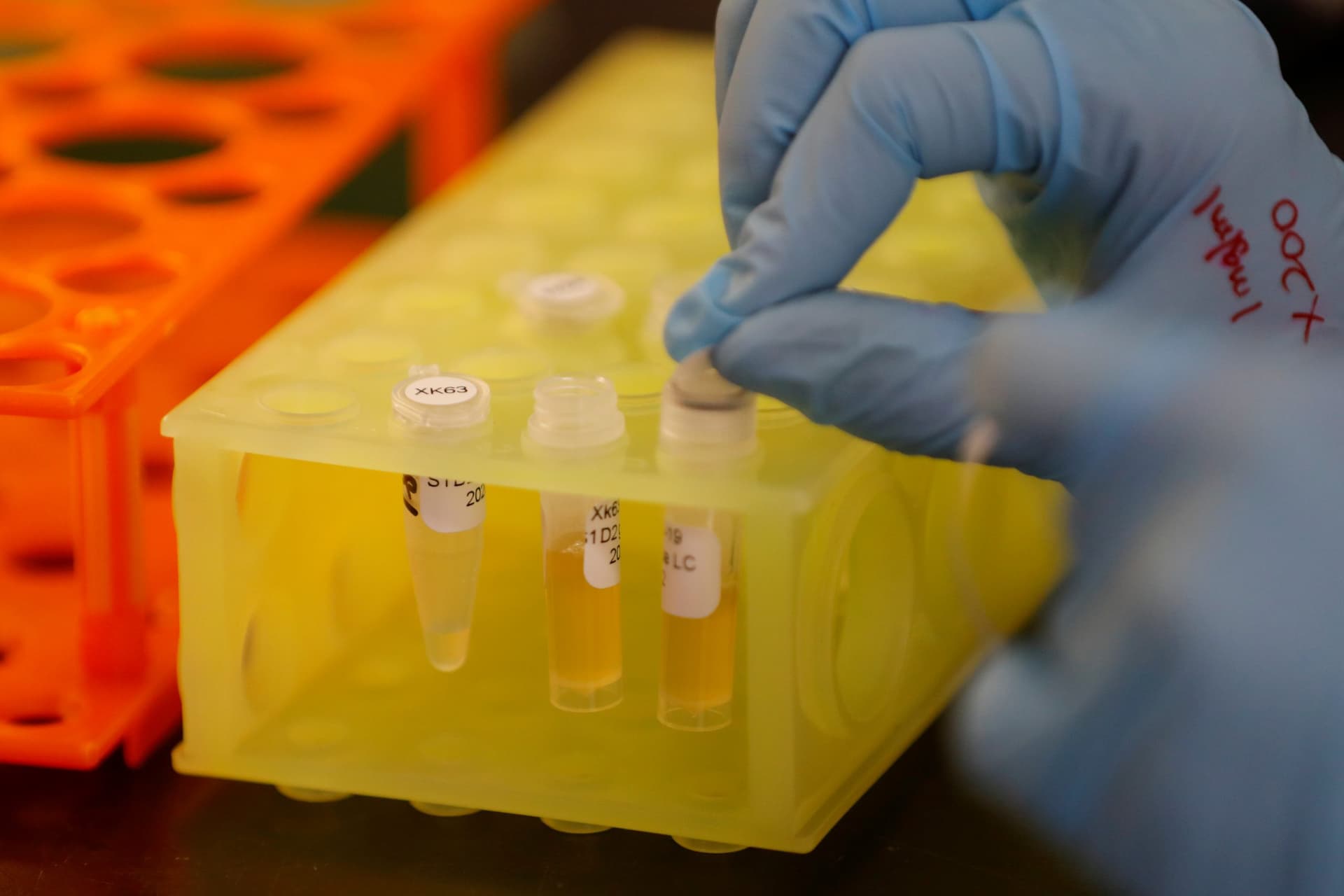 Next Big COVID-19 Treatment May Be Manufactured Antibodies